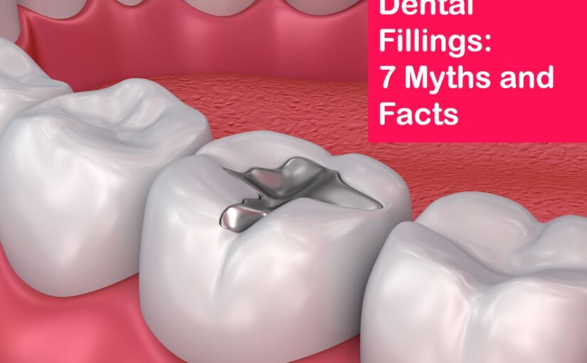 Dental Fillings: 7 Myths And Facts